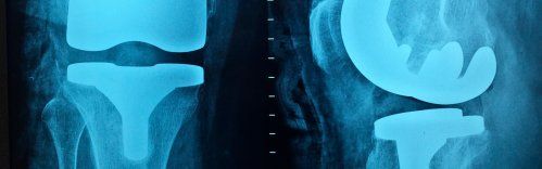 Ortopedia y prótesis Santander
